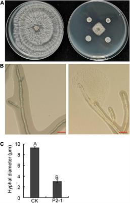 Isolation and Characterization of Bacillus velezensis Strain P2-1 for Biocontrol of Apple Postharvest Decay Caused by Botryosphaeria dothidea